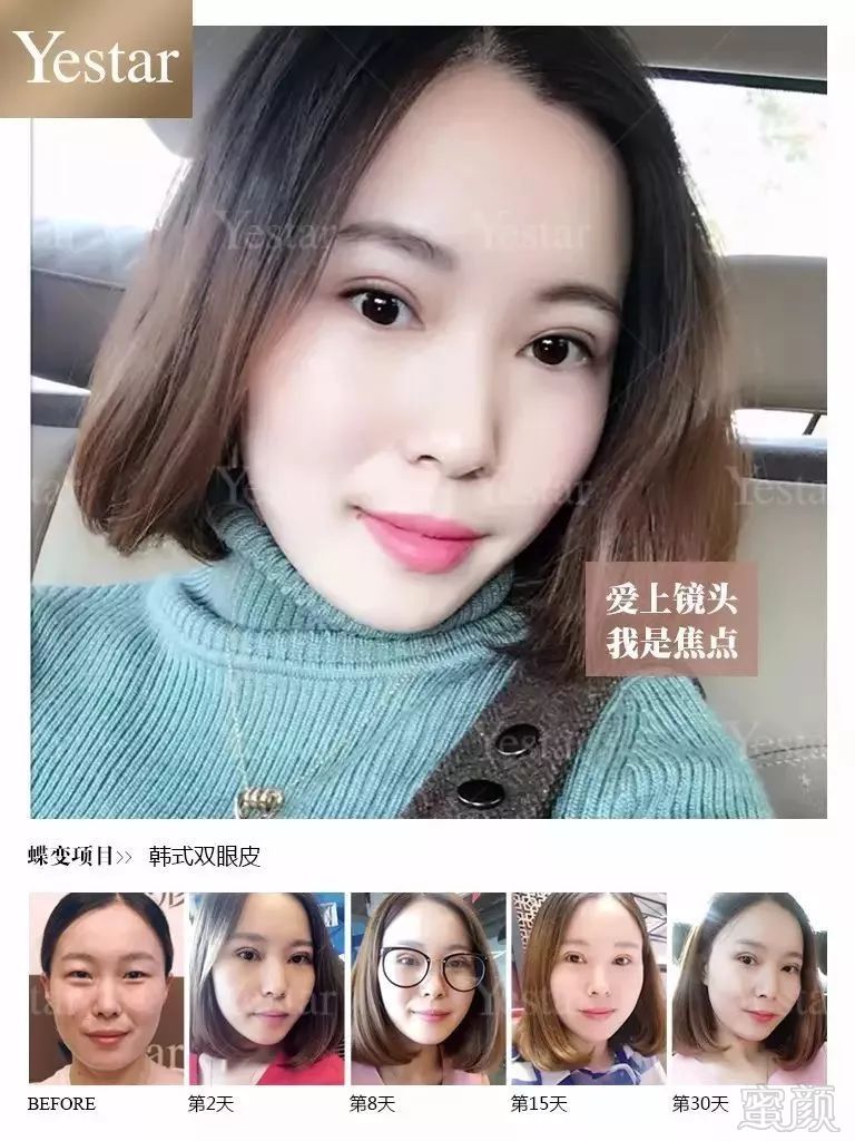 案例图片