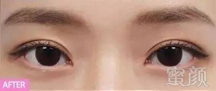 https://img.miyanlife.com/mnt/timg/180323/133Z4K02-9.jpg