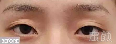 https://img.miyanlife.com/mnt/timg/180323/133Z4KX-8.jpg