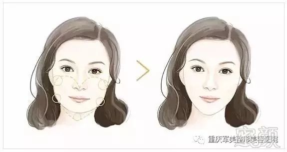 https://img.miyanlife.com/mnt/timg/180324/1030241P9-1.jpg