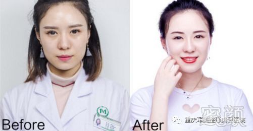 https://img.miyanlife.com/mnt/timg/180324/103024D47-2.jpg