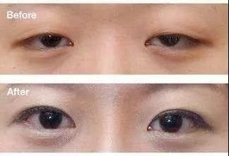 https://img.miyanlife.com/mnt/timg/180324/10342113D-3.jpg