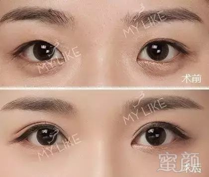https://img.miyanlife.com/mnt/timg/180324/1034234021-10.jpg
