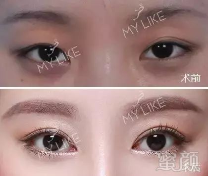 https://img.miyanlife.com/mnt/timg/180324/1034235212-11.jpg