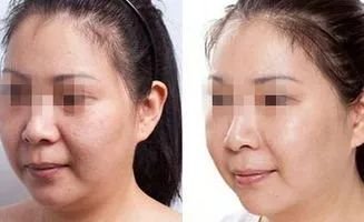 https://img.miyanlife.com/mnt/timg/180324/1035043113-3.jpg