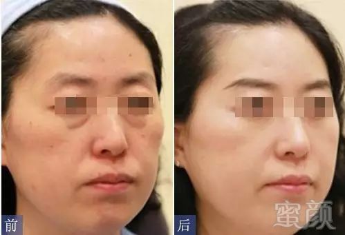 https://img.miyanlife.com/mnt/timg/180324/1035044Q4-4.jpg
