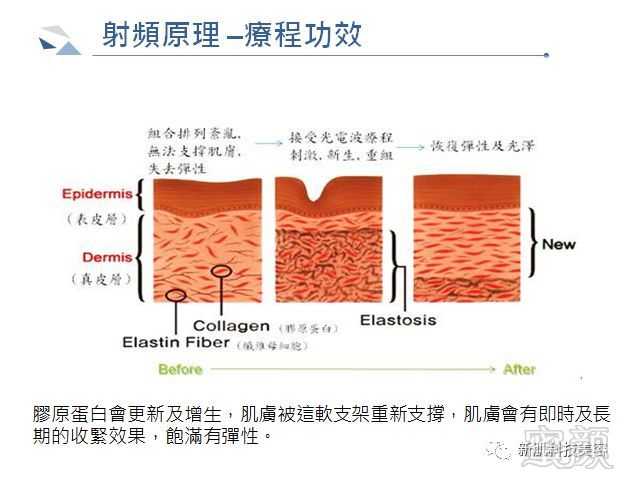 案例图片