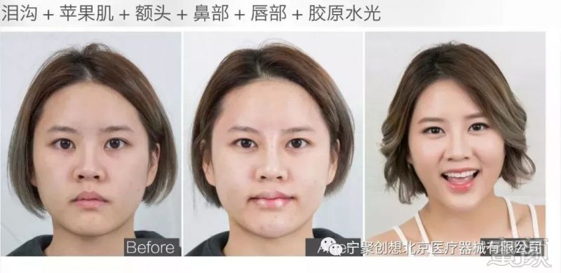 https://img.miyanlife.com/mnt/timg/180324/105S62V3-5.jpg