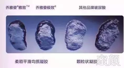 https://img.miyanlife.com/mnt/timg/180324/11040A213-14.jpg