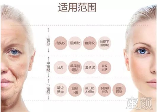 https://img.miyanlife.com/mnt/timg/180324/11040I619-15.jpg
