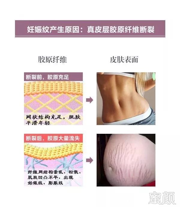 https://img.miyanlife.com/mnt/timg/180324/11052164U-0.jpg