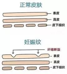 https://img.miyanlife.com/mnt/timg/180324/1105226400-1.jpg