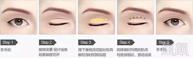 https://img.miyanlife.com/mnt/timg/180324/11115310a-4.jpg