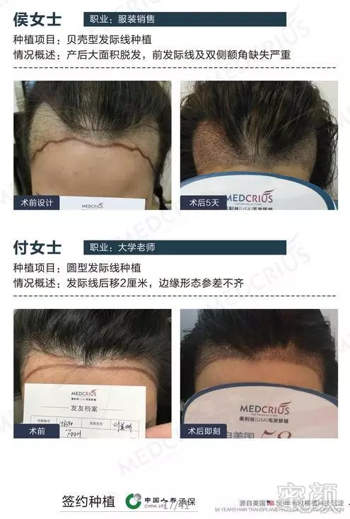 https://img.miyanlife.com/mnt/timg/180324/1116392127-8.jpg