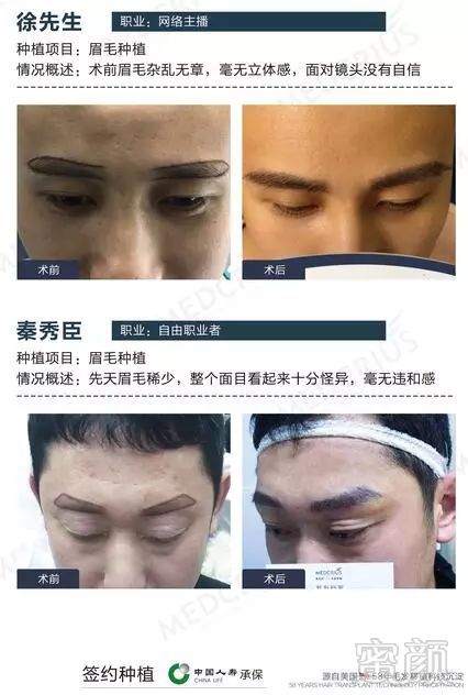 https://img.miyanlife.com/mnt/timg/180324/1116392F1-7.jpg