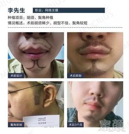https://img.miyanlife.com/mnt/timg/180324/1116415394-9.jpg