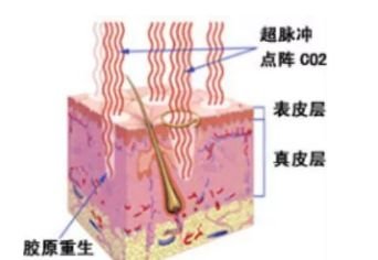 案例图片