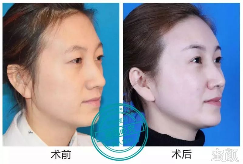 https://img.miyanlife.com/mnt/timg/180324/1215252N4-4.jpg