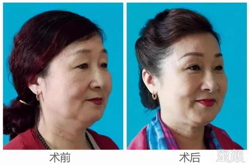 https://img.miyanlife.com/mnt/timg/180324/12152564F-5.jpg
