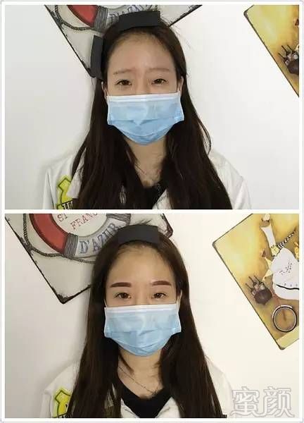 https://img.miyanlife.com/mnt/timg/180324/121U3L01-9.jpg