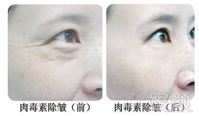 https://img.miyanlife.com/mnt/timg/180324/1233213J5-2.jpg