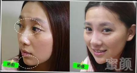 https://img.miyanlife.com/mnt/timg/180324/1336104R3-0.jpg