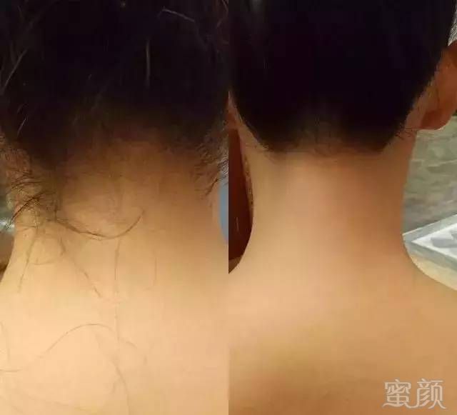 https://img.miyanlife.com/mnt/timg/180324/1341262962-12.jpg