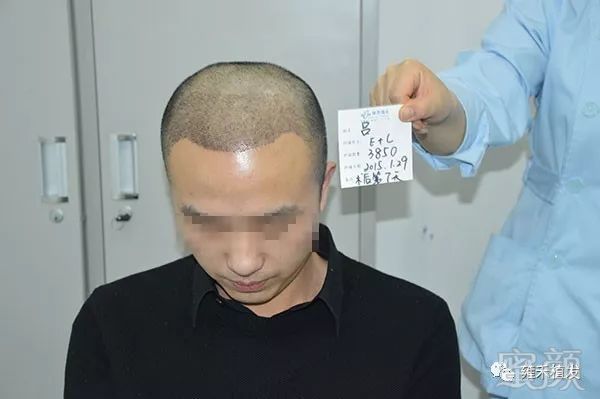 https://img.miyanlife.com/mnt/timg/180324/135AJ531-5.jpg