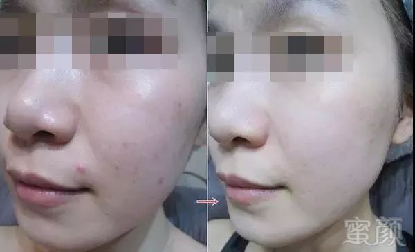 https://img.miyanlife.com/mnt/timg/180324/135T12X2-4.jpg