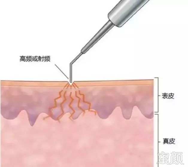 案例图片