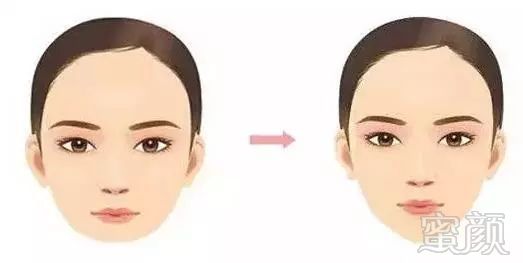 https://img.miyanlife.com/mnt/timg/180324/140IC4B-0.jpg