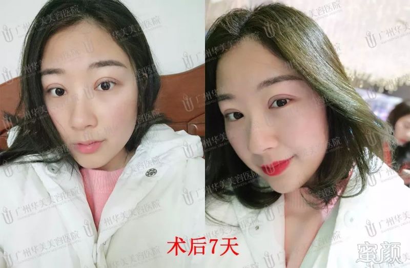 https://img.miyanlife.com/mnt/timg/180324/140S54515-5.jpg