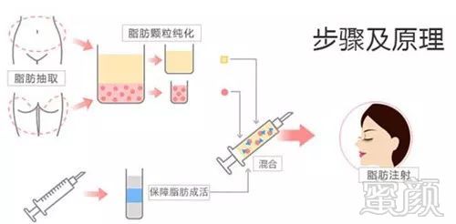 案例图片