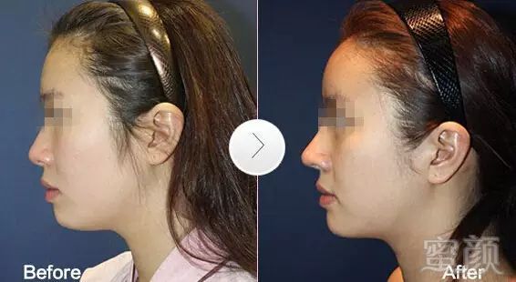 https://img.miyanlife.com/mnt/timg/180325/130I11960-4.jpg