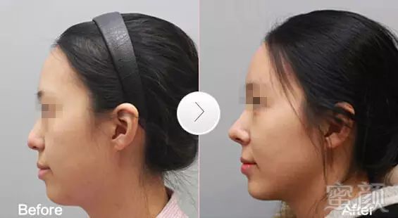 https://img.miyanlife.com/mnt/timg/180325/130I1F06-3.jpg