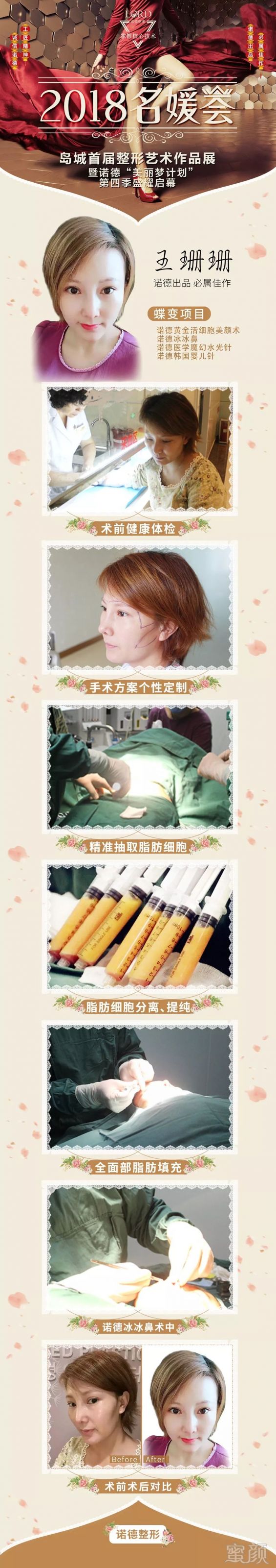 https://img.miyanlife.com/mnt/timg/180325/13125355Q-6.jpg