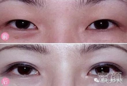 https://img.miyanlife.com/mnt/timg/180325/131K56103-1.jpg