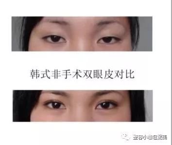 https://img.miyanlife.com/mnt/timg/180325/131K5DS-0.jpg