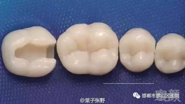 https://img.miyanlife.com/mnt/timg/180325/1320223361-1.jpg