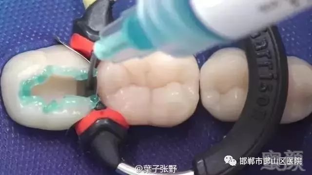 https://img.miyanlife.com/mnt/timg/180325/1320233556-4.jpg