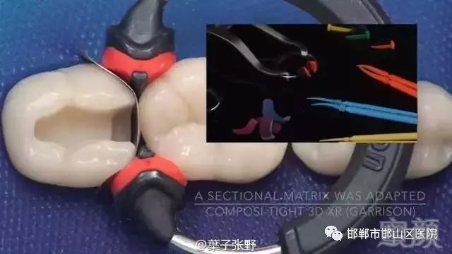 https://img.miyanlife.com/mnt/timg/180325/1320234394-3.jpg