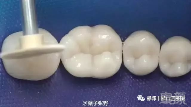 https://img.miyanlife.com/mnt/timg/180325/1320252421-11.jpg