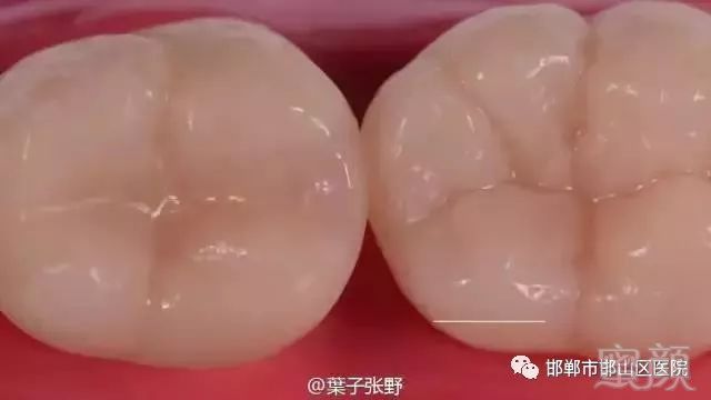 https://img.miyanlife.com/mnt/timg/180325/13202532U-13.jpg