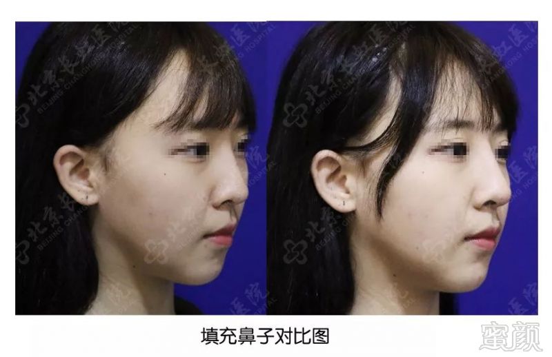 https://img.miyanlife.com/mnt/timg/180325/13240131X-2.jpg
