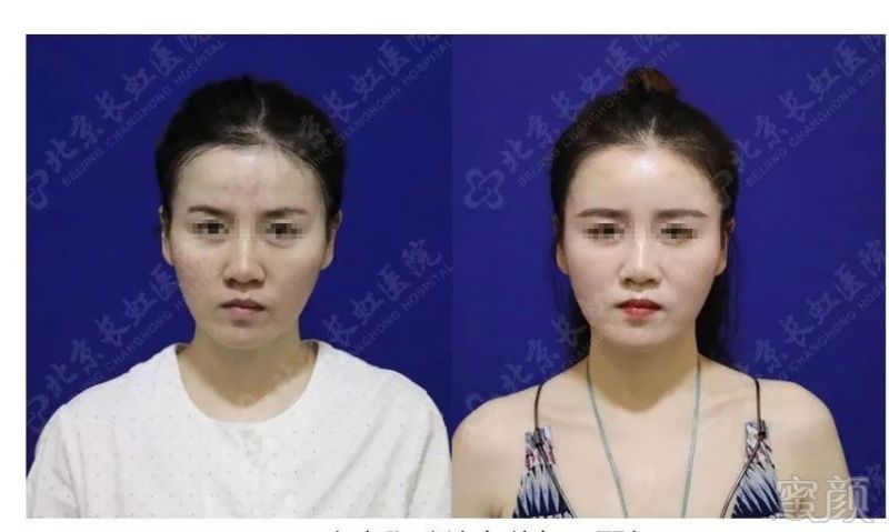 https://img.miyanlife.com/mnt/timg/180325/1324014058-1.jpg