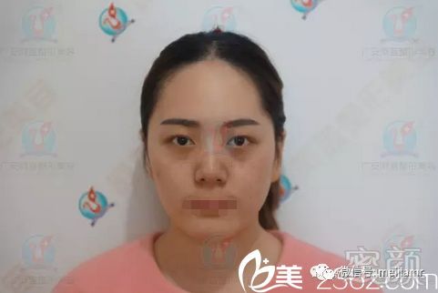 https://img.miyanlife.com/mnt/timg/180325/13260033T-0.jpg