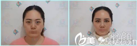 https://img.miyanlife.com/mnt/timg/180325/13260112R-2.jpg