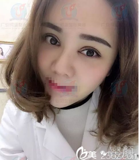 https://img.miyanlife.com/mnt/timg/180325/1326025400-5.jpg