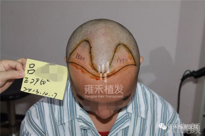 https://img.miyanlife.com/mnt/timg/180325/13313130G-2.jpg