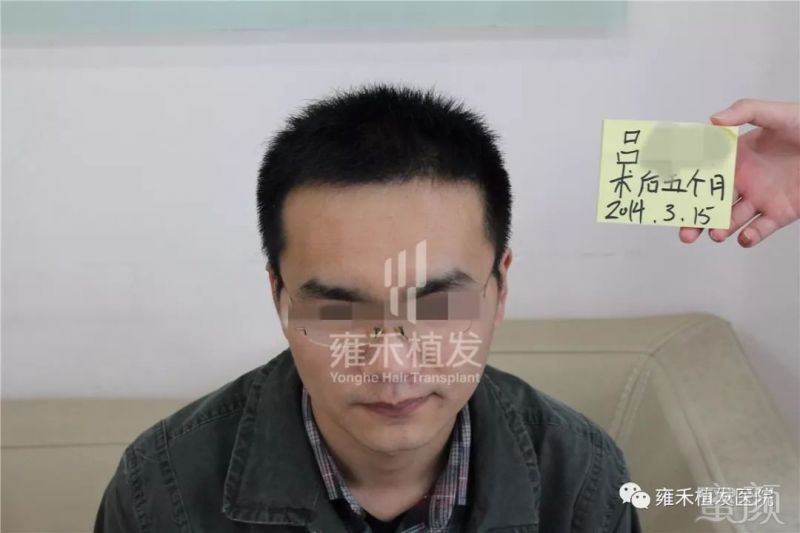 https://img.miyanlife.com/mnt/timg/180325/1331323A4-3.jpg